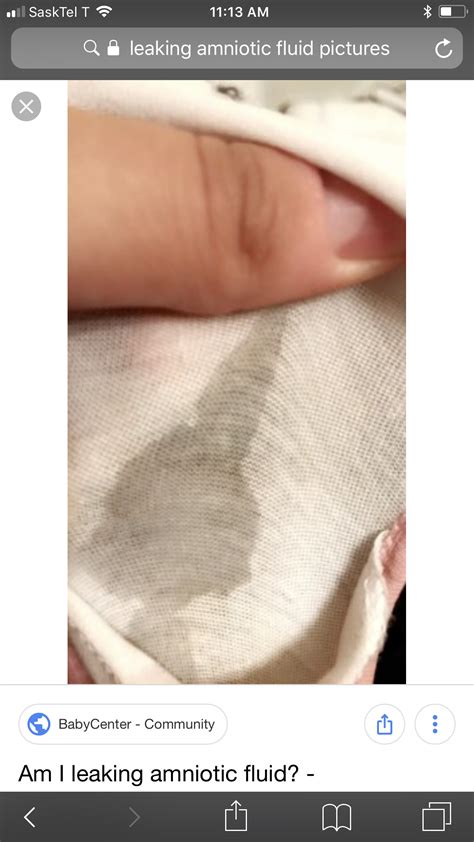 How To Know You Have Enough Amniotic Fluid at Carolyn Dixon blog