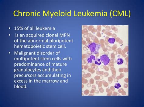 PPT - LEUKEMIA- CHRONIC MYELOID LEUKEMIA PowerPoint Presentation, free download - ID:9000287