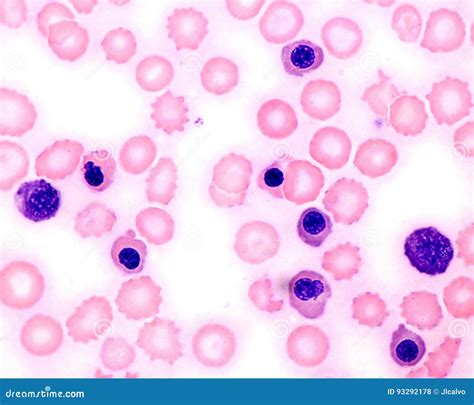 Nucleated Red Blood Cells