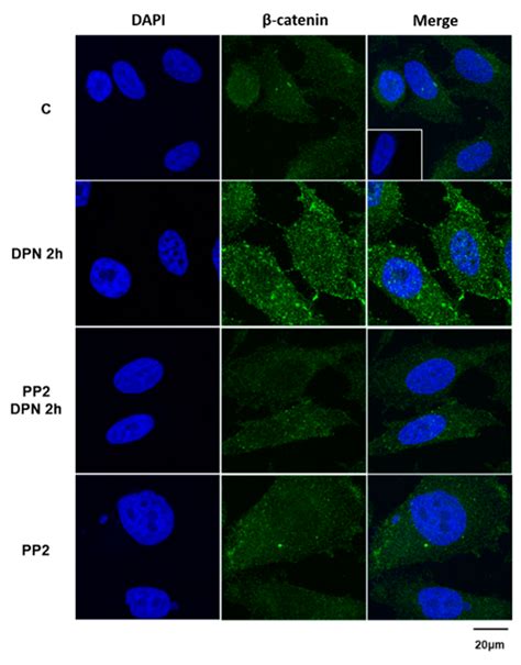 Estrogen Receptor Signaling Pathways Involved in Invasion and Colony ...