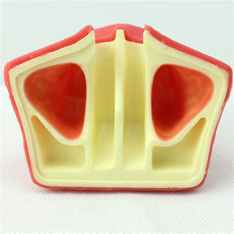 Buy Educational Model Oral Dental Im Surgery Maxillary Maxillary Sinus ...