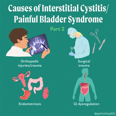 Interstitial Cystitis/Bladder Pain Syndrome: Diagnosis and Subtypes