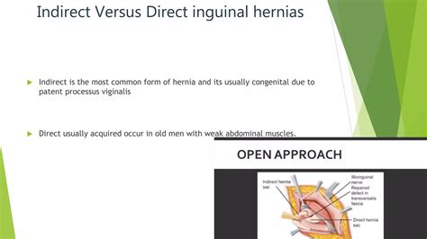 hernia 2 .pptx