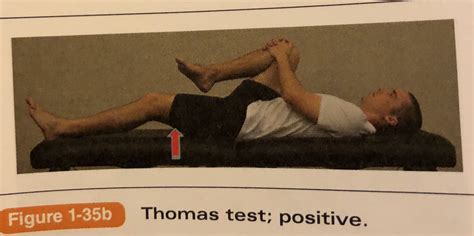 Positive Thomas Test