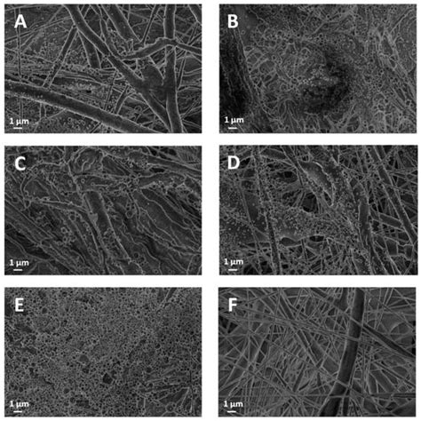 Electrospun PCL Filtration Membranes Enhanced with an Electrosprayed ...