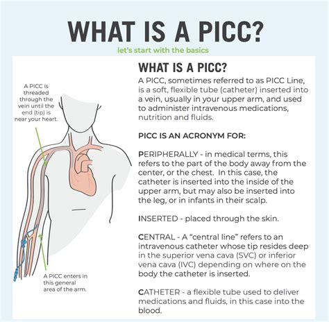 Get the Ultimate Guide to PICCs here.