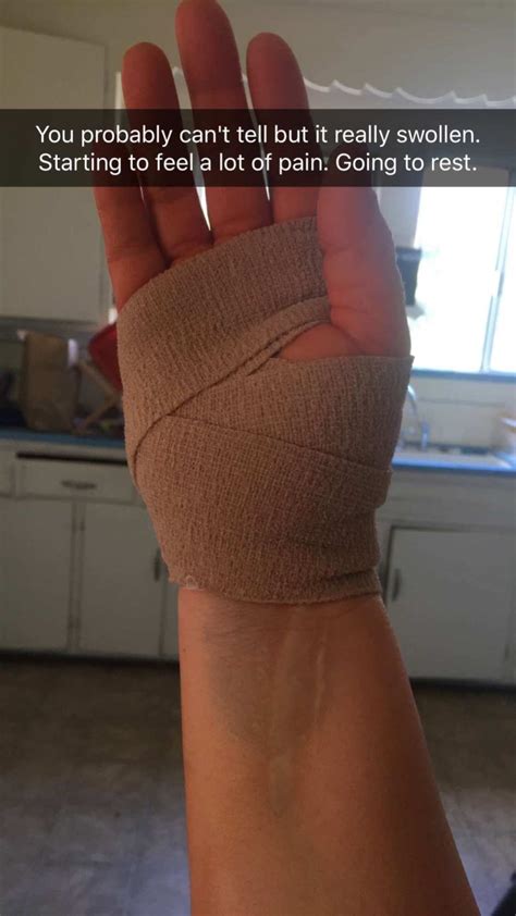 Carpal Tunnel Surgery Recovery: 3 Months Later - 24/7 Modern Mom™