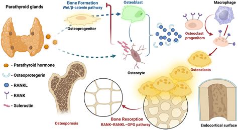 Hungry Bone Syndrome After Parathyroidectomy for Secondary ...
