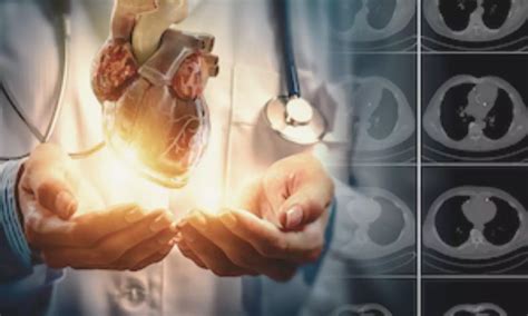 Deep Learning CAC from routine Noncardiac CT Scans may predict ...