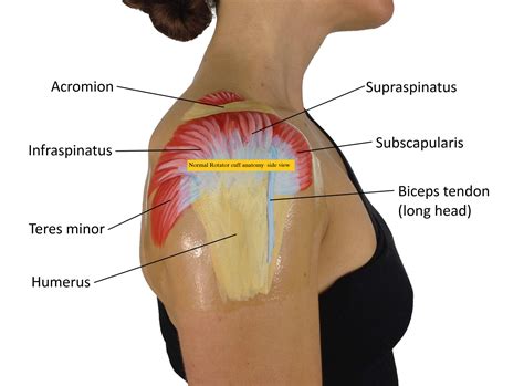 Rotator Cuff Pain Location