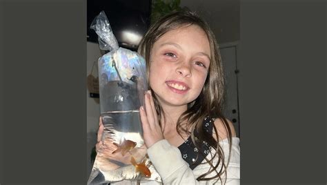 Alabama 9-year-old faces long recovery after vicious dog attack: ‘It ...