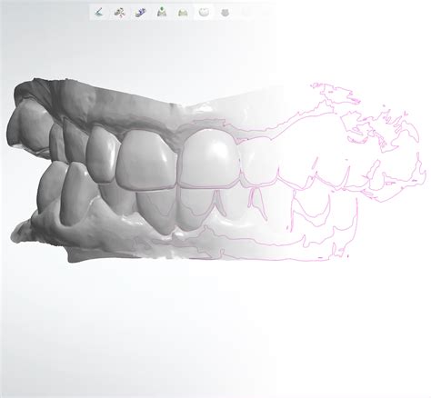 Image result for 3Shape Tutorials