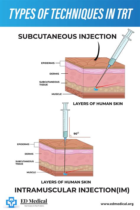 Testosterone Injection Sites 的图像结果