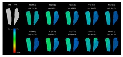 Hepatic Lipidomics and Molecular Imaging in a Murine Non-Alcoholic ...