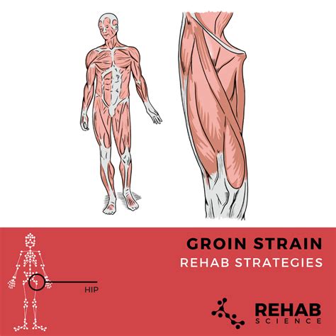 Pulling Groin Symptoms