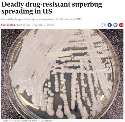 美CDC证实医疗机构爆“超级真菌”传播 已致3死-美国看台-万维读者网（电脑版）