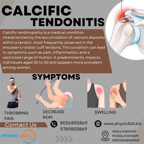 Physio360Chennai on LinkedIn: Calcific tendonitis is a medical condition characterized by the ...