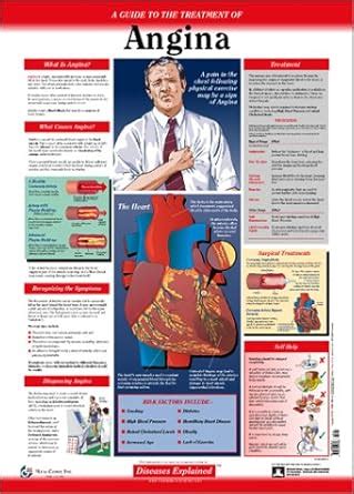 Diseases Explained: Angina Wall Chart : Lexi-Comp: Amazon.in: Books