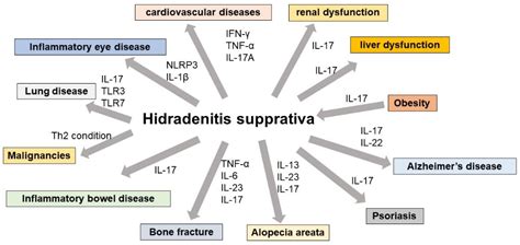 The Development of Systemic Inflammatory Diseases in Hidradenitis Suppurativa