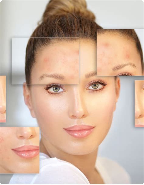 Stretch Mark Cream CICA - Phade