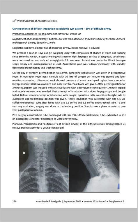 Image result for Difficult Intubation Face