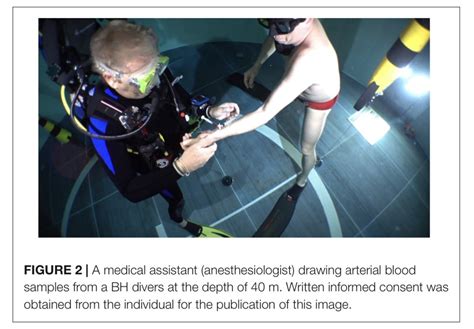 Image result for PaO2/FiO2 Alveoli