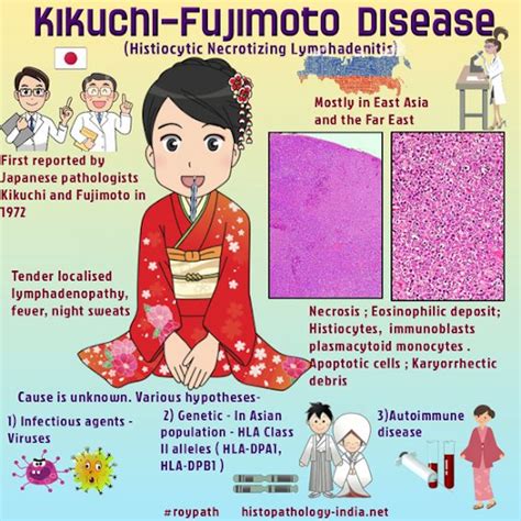 Kikuchi-Fujimoto disease (KFD) - histiocytic necrotizing lymphadenitis