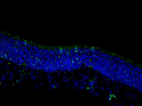 TRPM5 antibody (18027-1-AP) | Proteintech