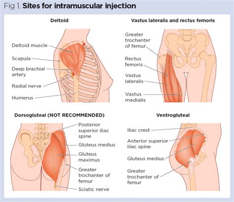 Image result for Injection Sites