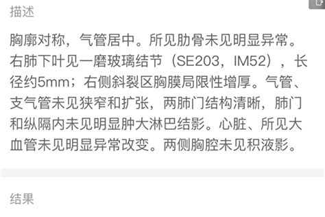 杭州29岁姑娘干咳一周 无症状确诊肺癌 | 大纪元
