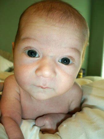 Sugar Bug - Blue Vein on bridge of nose. Anyone heard of this? | BabyCenter