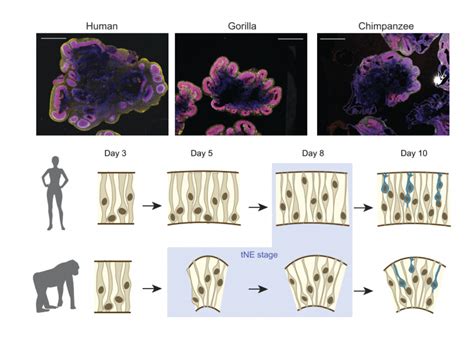 Image result for Forebrain Evolution