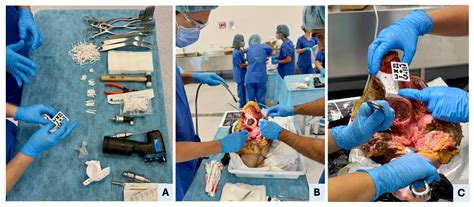 Feasibility and Accuracy of a Dual-Function AR-Guided System for PSI ...