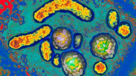 Starbucks worker in New Jersey contracts hepatitis A | FOX 5 New York