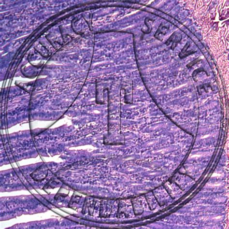 Image result for Jejunum Microscope