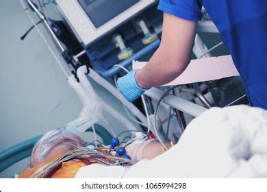 Image result for Normal vs Abnormal ECG