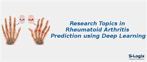 Rheumatoid Arthritis Prediction using Deep Learning | S-Logix
