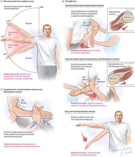Rotator Cuff Muscles Test 的图像结果
