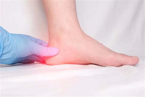 Plantar Fasciitis: Do You Have It? - Active Sports Therapy