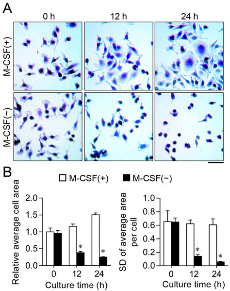 Synchronized Cell Cycle Arrest Promotes Osteoclast Differentiation