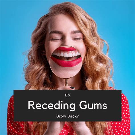 Do Receding Gums Grow Back? - Channo DDS
