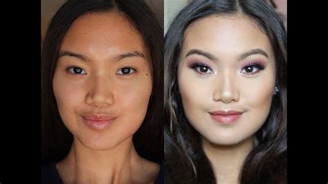 Image result for Tooth Extraction Side Profile