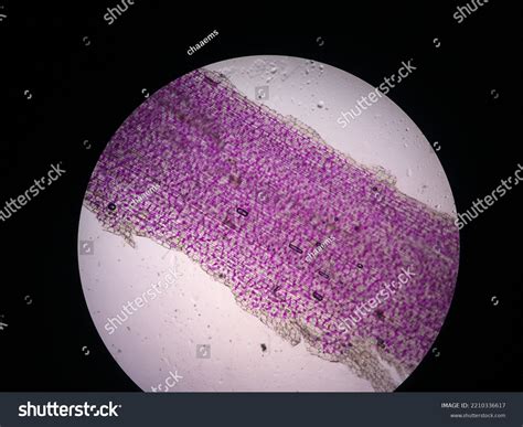 Onion Epidermal Cell