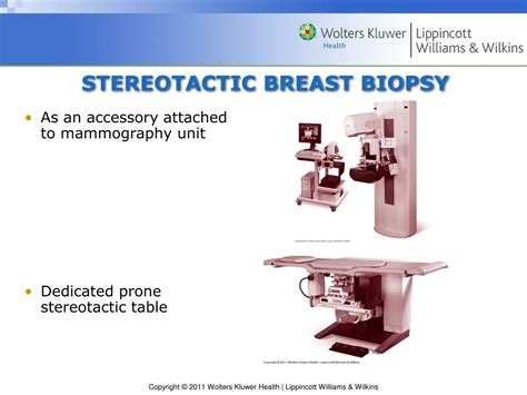 PPT - Minimally Invasive Needle Breast Biopsy - Techniques and ...
