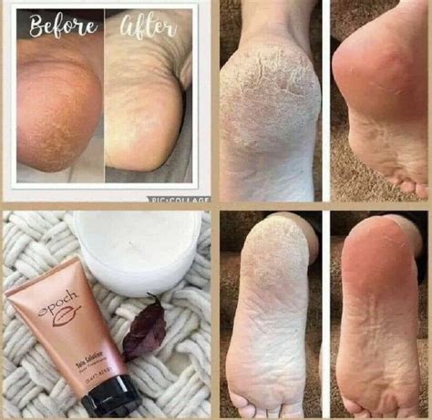 Buy Nuskin Epoch Sole Solution Foot Treatment 4.2 fl OZ Online at ...