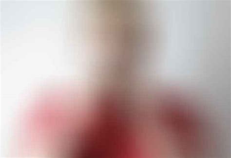 Image result for Peripheral Vision Loss