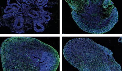 Molecular map of brain organoids reveals unprecedented levels of ...
