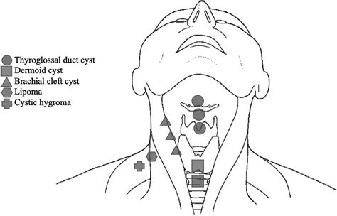 Anterior Midline Neck Mass in an Adolescent - The Journal of Pediatrics
