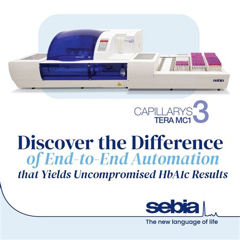 Image result for Sebia Reagent