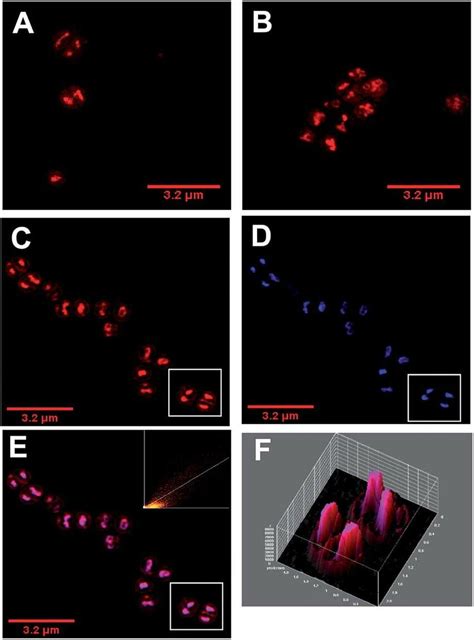 Image result for Super-Resolution Microscopy